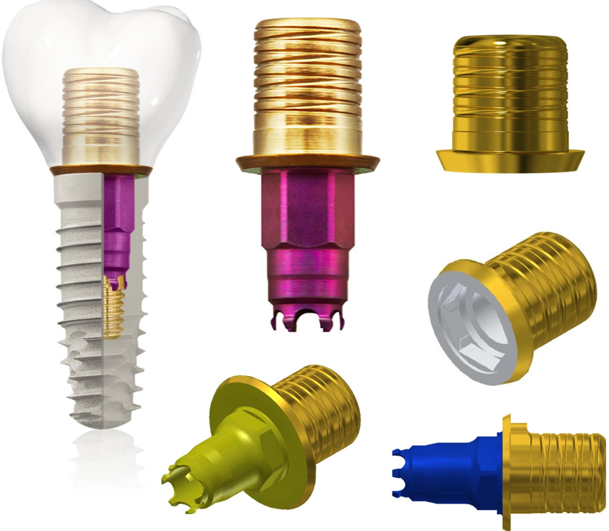Dental Implants